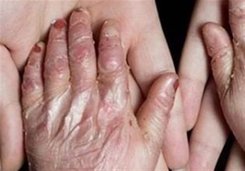 تحریمهای آمریکا سلاحی علیه جان کودکان بیگناه است تحریمهای آمریکا سلاحی علیه جان کودکان بیگناه است