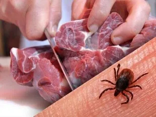 یک مورد تب کریمه در ایلام شناسایی شد