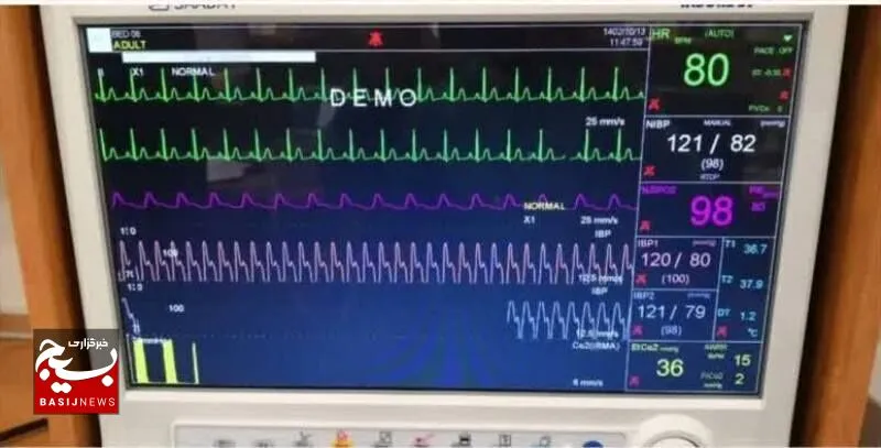اهدای تجهیزات پزشکی به مراکز درمانی سبزوار توسط خیران سلامت