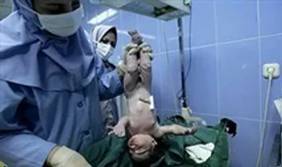 امروزه با پیشرفت علم پزشکی ۹۶ درصد از زنان نابارور، باردار می&zwnj;شوند
