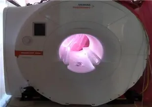 بيمارستان حکيم نيشابور به دستگاه تشخيصي MRI محهز شد