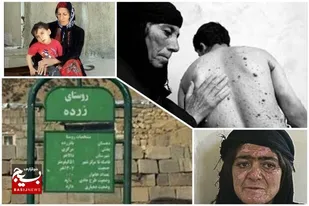 روایتی از بمباران شیمیایی هیروشیمای ایران
