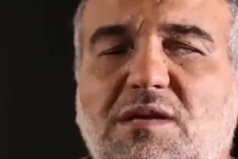 جانباز ایرانی، پزشک آلمانی را متحول کرد