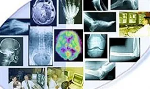 اطلاق یارانه و قیمت ارزان، یکی از علل افزایش درخواست انجام MRI است